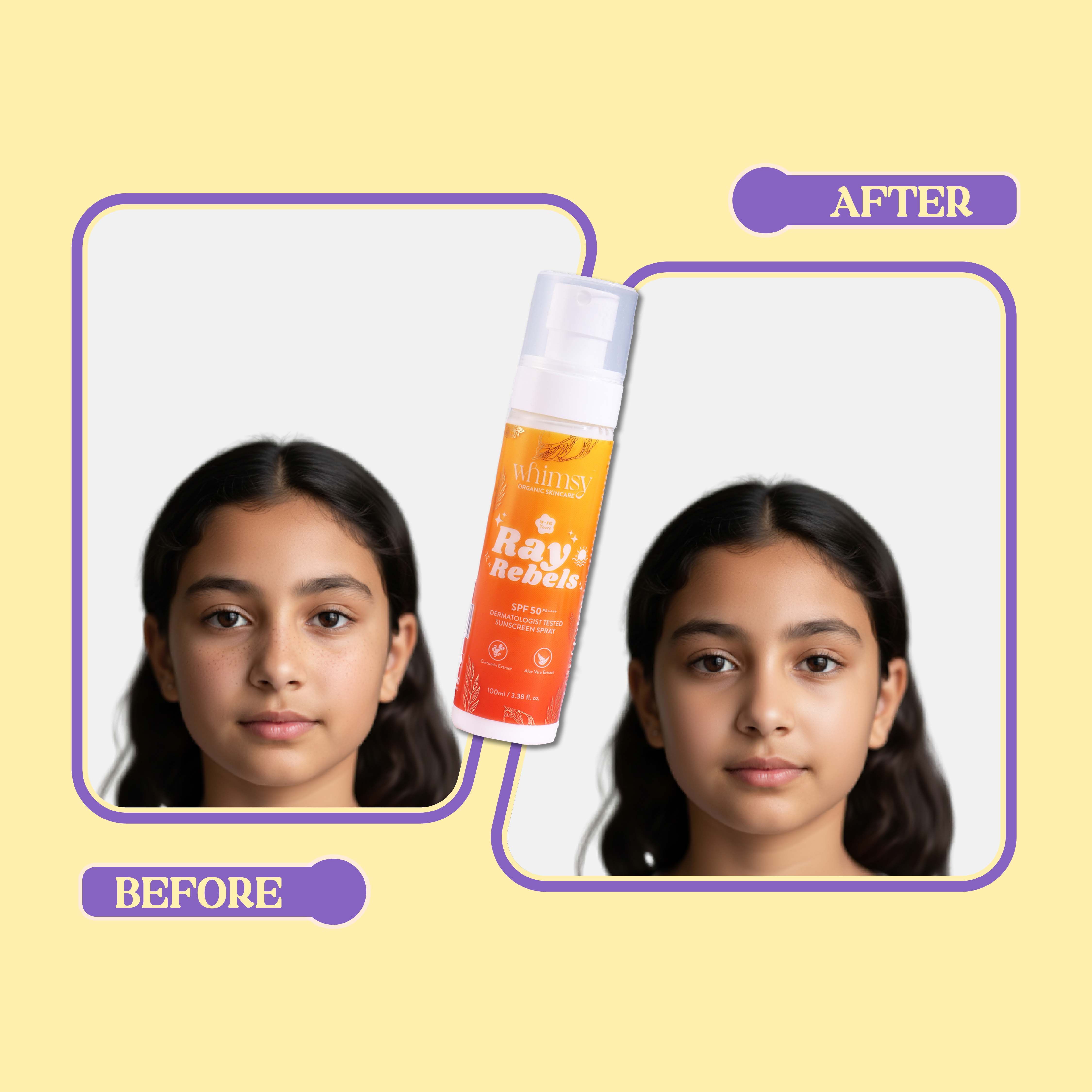 Whimsy Ray Rebels Sunscreen Spray - 100 ML (4-16 Years)