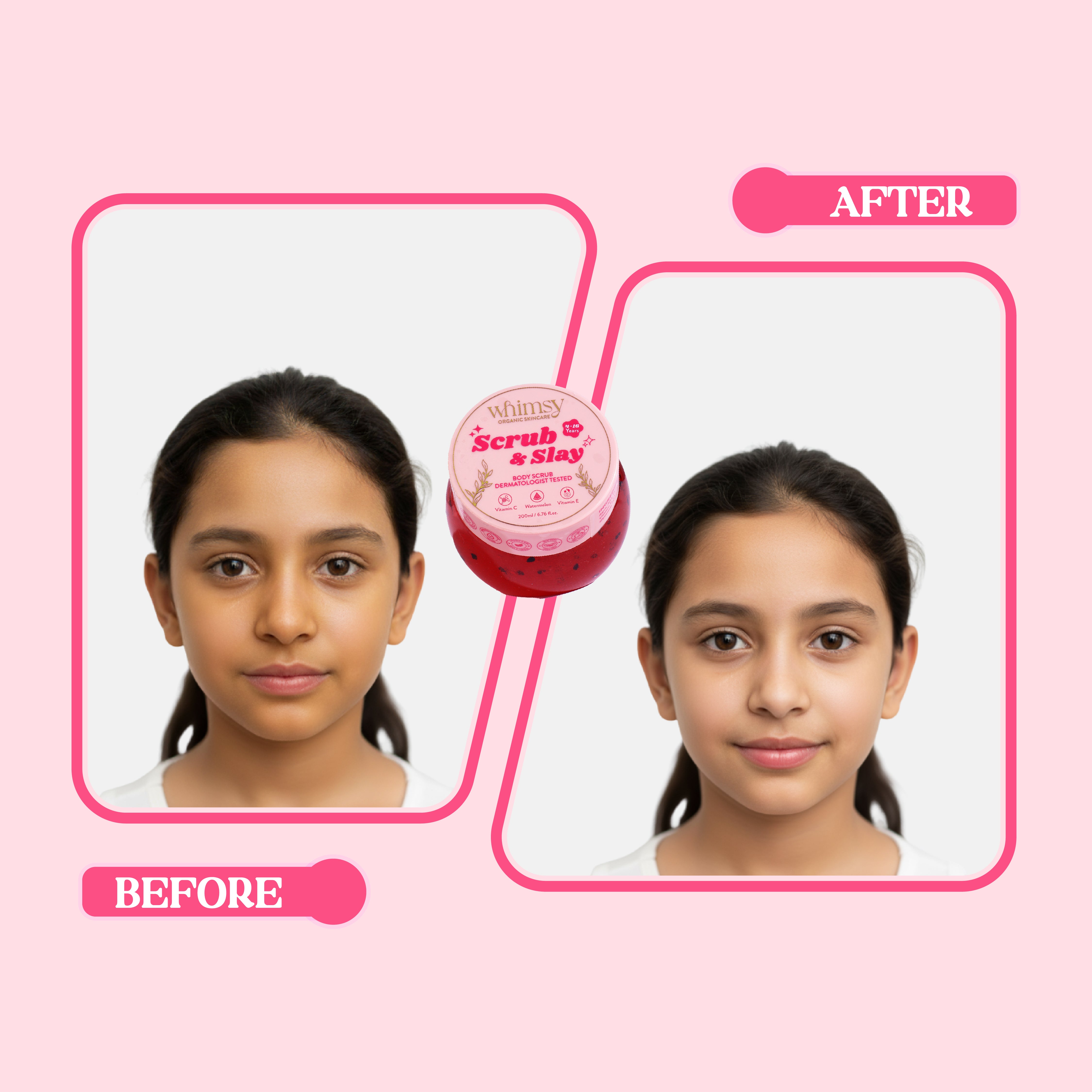 Whimsy Watermelon Body Scrub (4-16 Years)