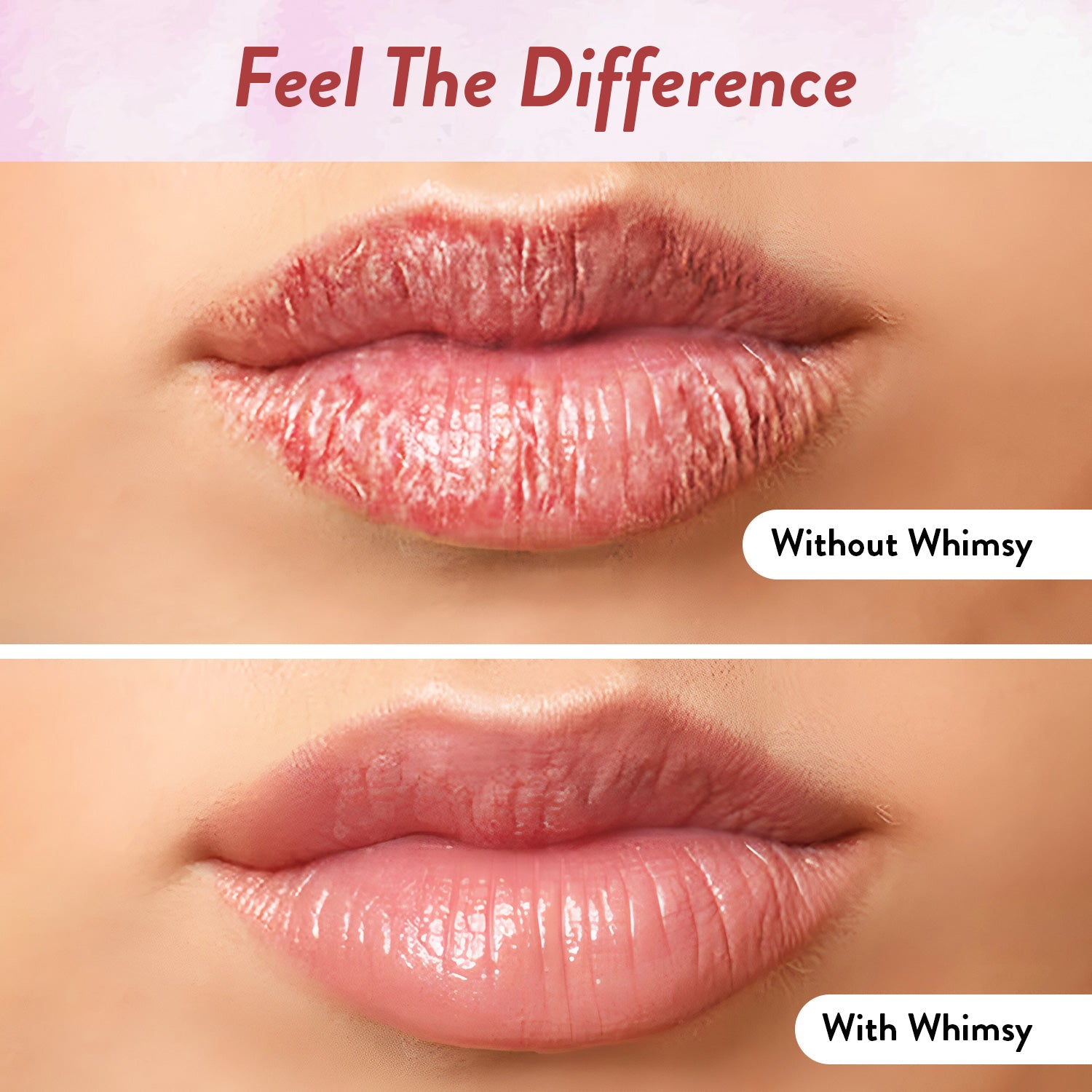 Whimsy Lip Gloss Combo- Pack of 2