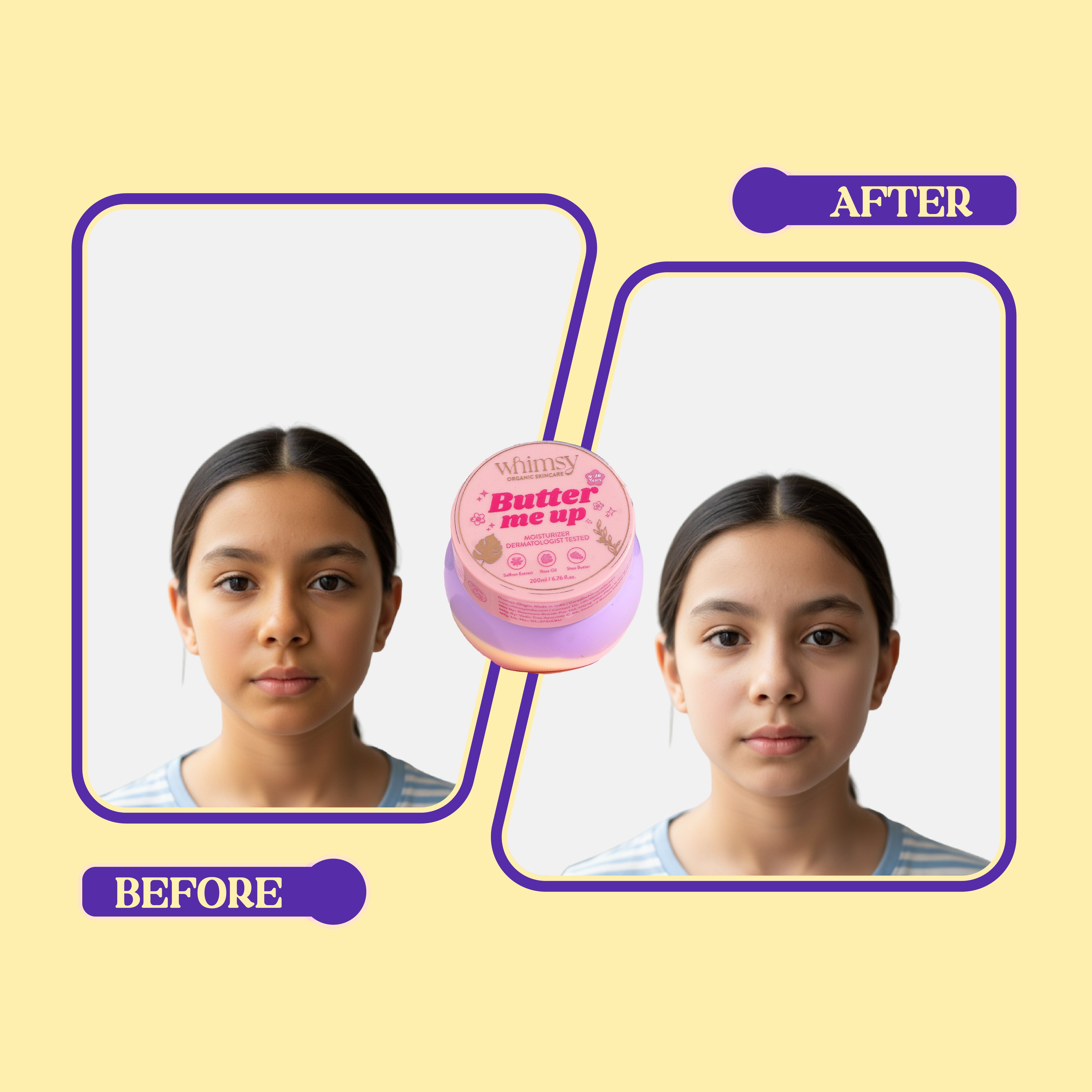 Whimsy Butter Me Up Body Butter - 180 ML (4-16 Years)