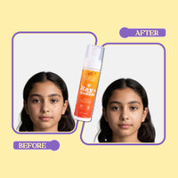 Whimsy Ray Rebels Sunscreen Spray