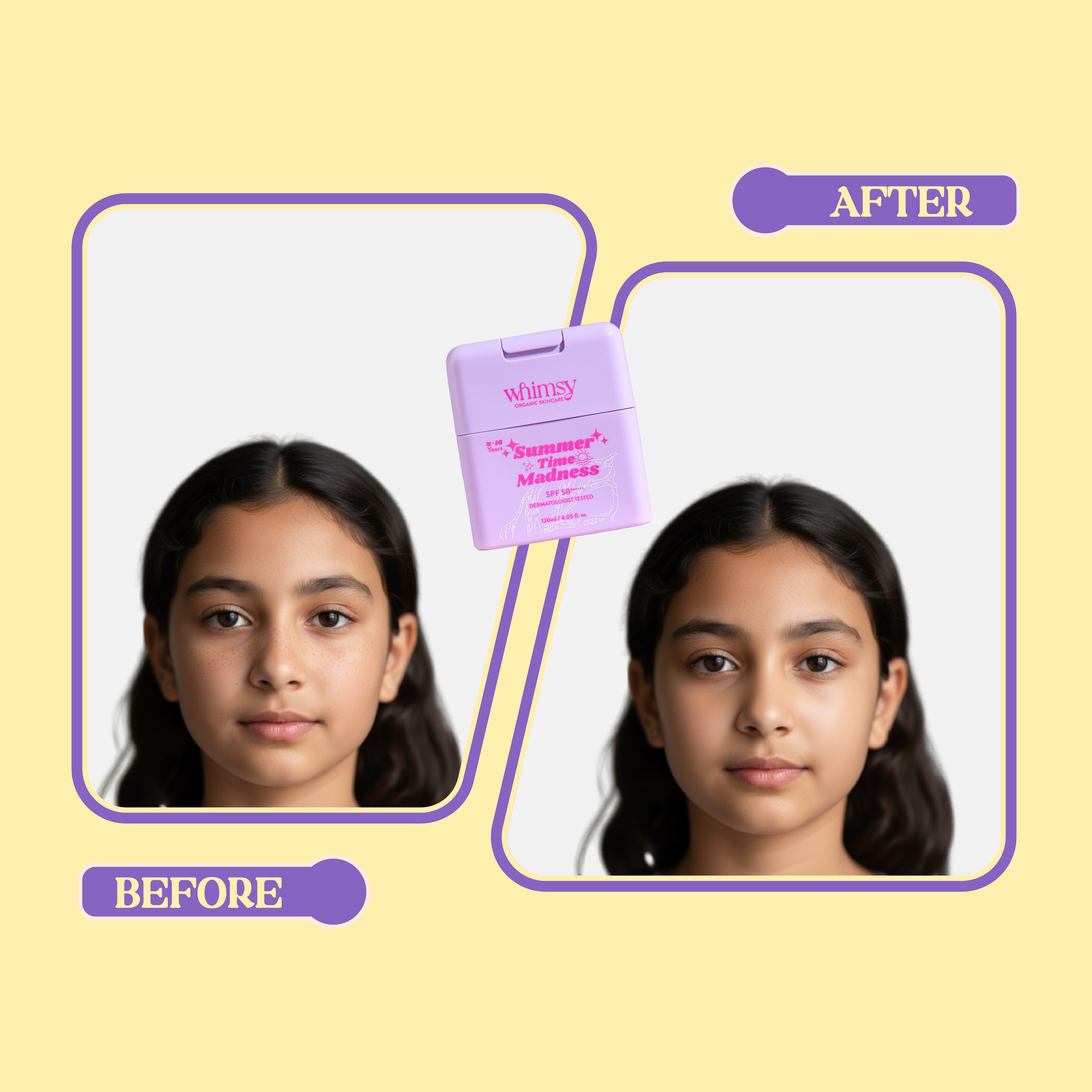 Whimsy Summer Time Madness Sunscreen 50+ - 120 ML (4-16 Years)